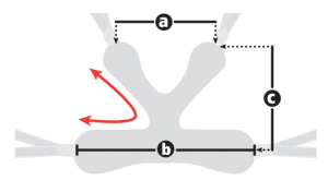 Medidas soporte pélvico E-Pacer - Rehagirona